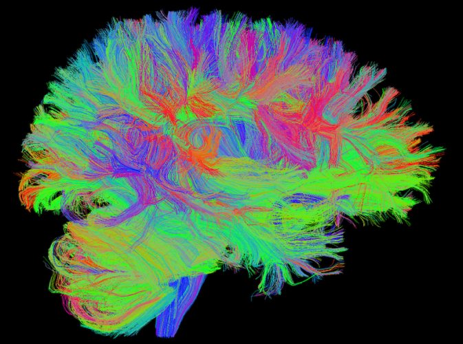 Colorized MRI brain scan